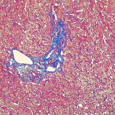 Masson's Trichrome Stain Bundle (16oz)