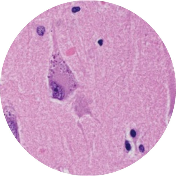 Control Slides, H&E - Human Brain