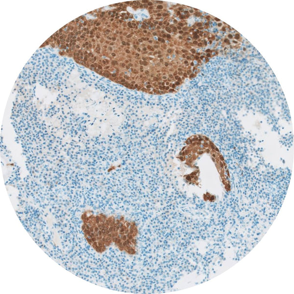 Control Slides, IHC - P16