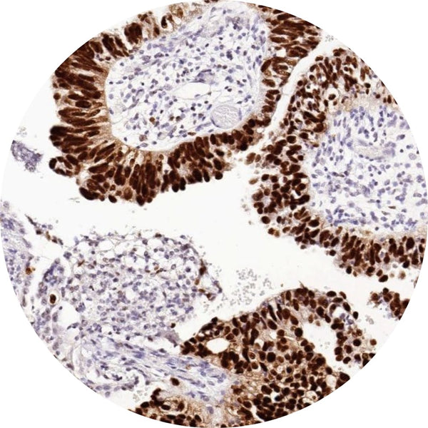 Control Slides, IHC - P53