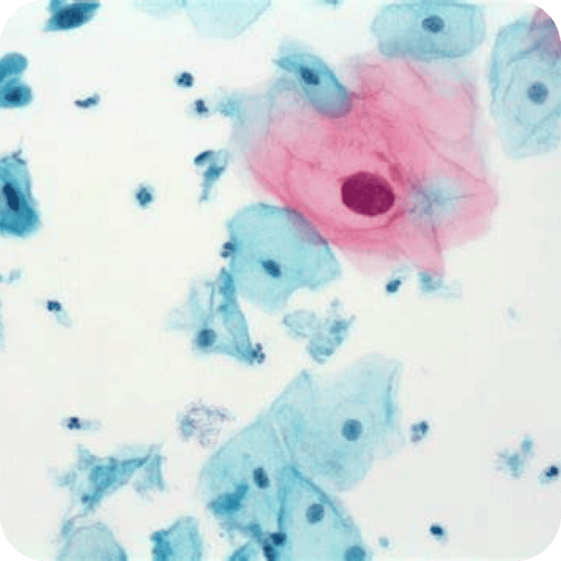 EA-65 Papanicolaou Stain
