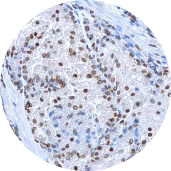 Control Slides, IHC - 5-HMC