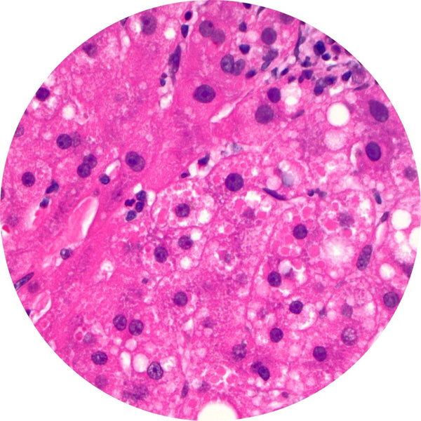 Control Slides, IHC - AAT (ALPHA-1 Antitrypsin)