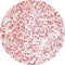 Control Slides, IHC - ACTH