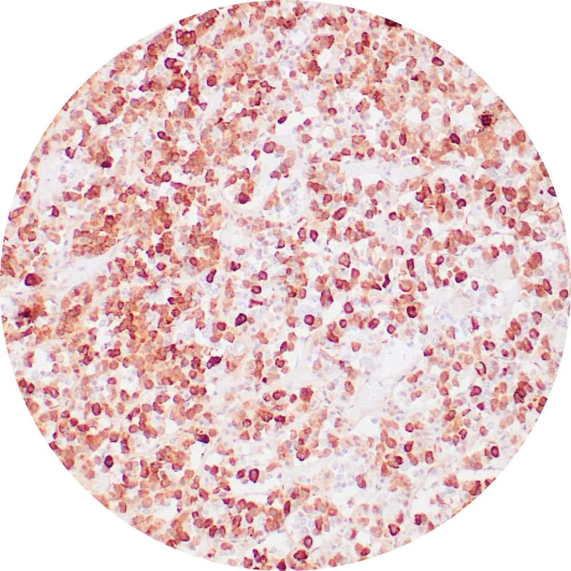 Control Slides, IHC - ACTH