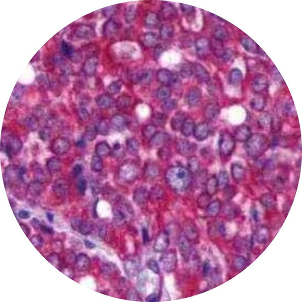 Control Slides, IHC - Adrenergic Receptor beta 2