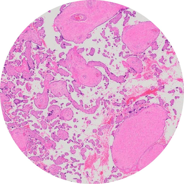 Control Slides, H&E - Human Placenta