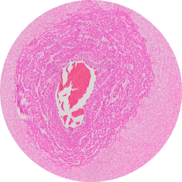 Control Slides, H&E - Human Umbilical Cord
