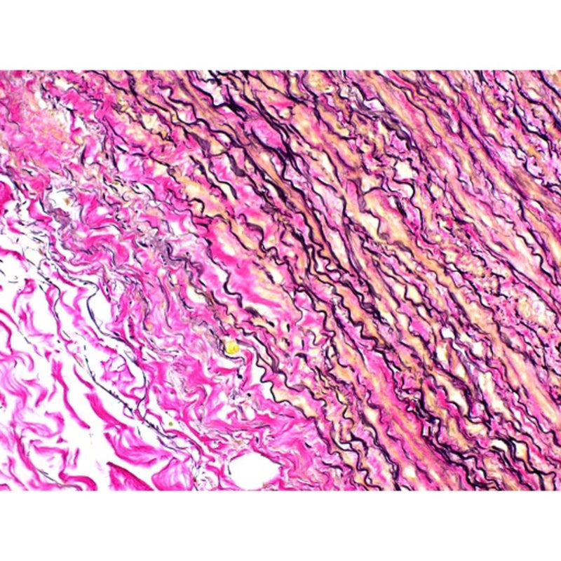 Elastic Stain Kit (Modified Verhoff’s), Volume Optimized