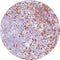 Control Slides, IHC - TdT