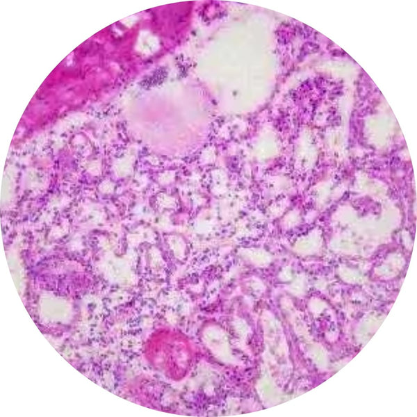 Control Slides, H&E - Human Kidney