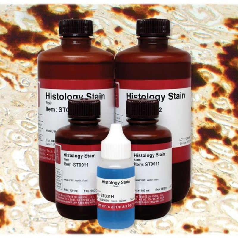 Alizarin Red Stain for Calcium Salts | Rankin Biomedical