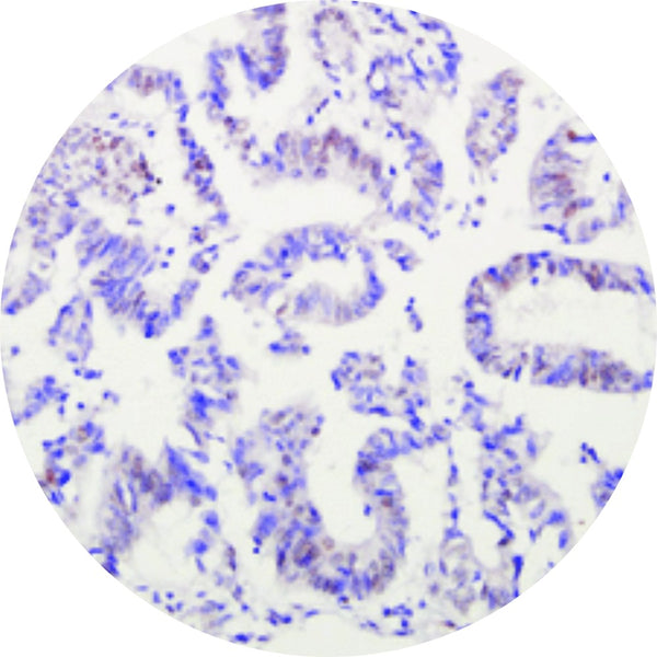 Control Slides, IHC - ARID1A