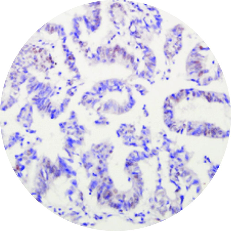 Control Slides, IHC - ARID1A