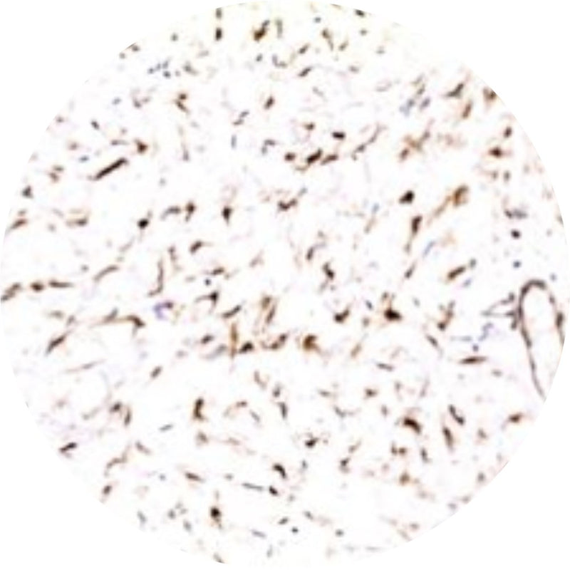 Control Slides, IHC - Beta Catenin