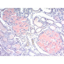 Amyloid Stain Kit (Congo Red) by Cancer Diagnostics, volume optimized consumables for amyloid detection in pathology slides.