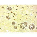 Bielshowsky's Stain Kit Volume Optimized by Cancer Diagnostics, consumable lab stain kit for tissue and cell analysis.