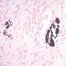 Calcium Stain Kit by Cancer Diagnostics, Modified Von Kossa, volume optimized for tissue staining, consumable laboratory reagent.
