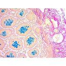 Colloidal Iron Stain Kit by Cancer Diagnostics, a consumable lab reagent for tissue staining, shown in the image.