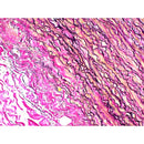 Elastic Stain Kit (Modified Verhoff’s) from Cancer Diagnostics, volume-optimized consumable for tissue staining procedures.