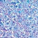 Eosinophil and mast cell stain kit from Cancer Diagnostics, volume optimized for histology and cell analysis.