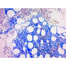 Giemsa Stain Kit by Cancer Diagnostics, May-Grunwald volume optimized, used for cell and blood smear staining in laboratory tests.