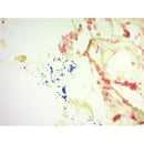 Gram Stain Kit by Cancer Diagnostics, modified Brown & Brenn, volume optimized for bacterial staining, shown in the image.