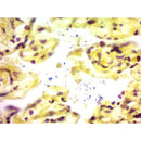 Gram stain kit by Cancer Diagnostics, volume optimized consumables for microbiology staining procedures, shown in the image.