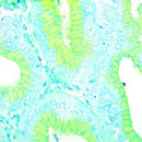 H. Pylori Stain Kit Alcian Yellow by Cancer Diagnostics, volume optimized consumables for medical staining procedures.