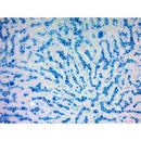 Iron Stain Kit by Cancer Diagnostics, volume-optimized consumables for histology and laboratory staining procedures.
