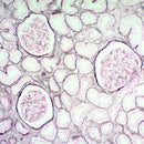 Jones Stain Kit by Cancer Diagnostics, a volume-optimized consumable for basement membrane staining, shown in the image.