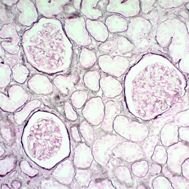 Jones Stain Kit, Volume Optimized, (Basement Membrane)