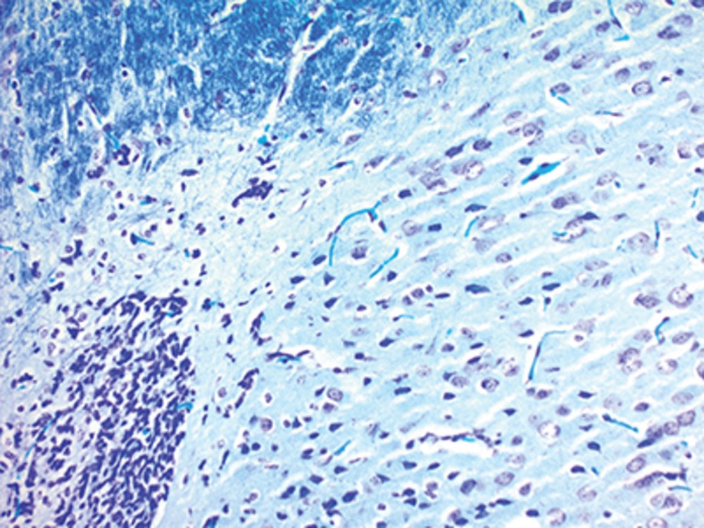 Luxol Fast Blue Stain Kit, Volume Optimized | Rankin Biomedical