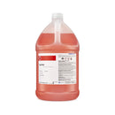 Lyse Red consumables with pump, 1-gallon size, used for laboratory sample processing, by Cancer Diagnostics.