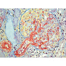 Martius Scarlet Blue (MSB) stain kit by Cancer Diagnostics, 500mL consumables for histology and lab staining processes.
