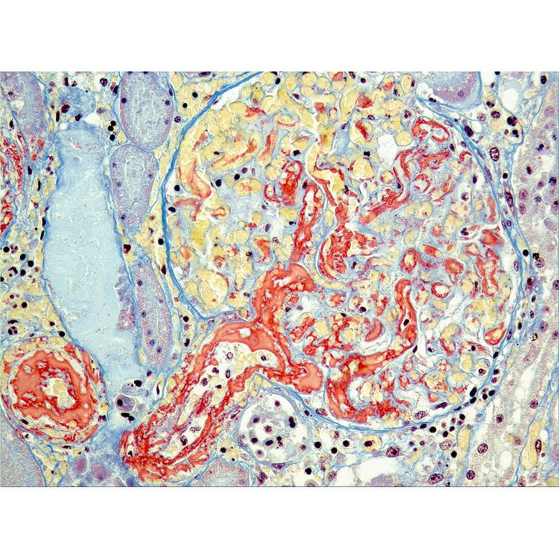 Msb Staining Martius Scarlet Blue (MSB) Stain Kit, 500mL | Rankin Biomedical