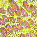 Mucicarmine stain kit by Cancer Diagnostics, Southgate, used for histology staining, shown with various consumable components.