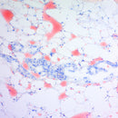 Oil Red O Stain Kit for fat detection by Cancer Diagnostics, showing stained tissue samples for lipid visualization.