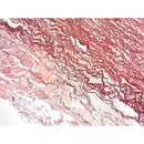 Orcein Stain Kit for Hepatitis B, volume optimized consumables by Cancer Diagnostics, used for tissue staining analysis.