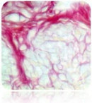 Picro-Sirius Red Stain Kit for cardiac muscle tissue, volume optimized, used in histology by Cancer Diagnostics.