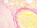 Picro-Sirius Red Stain Kit for collagen analysis by Cancer Diagnostics, showing prepared stained tissue sample for microscopic viewing.