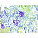 Pneumocystis stain kit from Cancer Diagnostics, volume optimized, shown in a clear container with labeled packaging.