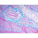Trichrome SK stain consumables by Cancer Diagnostics, used for tissue sample coloring with Modified Gomori's method.