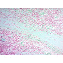 Twort's Counterstain Kit by Cancer Diagnostics, volume optimized, with various consumable stain bottles and testing supplies.