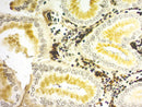 Warthin-Starry Stain Kit for consumables by Cancer Diagnostics, showing bottles and staining tools in a laboratory setting.