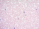 Wright-Giemsa Stain Kit by Cancer Diagnostics, volume optimized, in a lab consumables box for blood and cell microscopy.