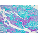 AFB (Ziehl-Neelsen) Stain Kit, Volume Optimized