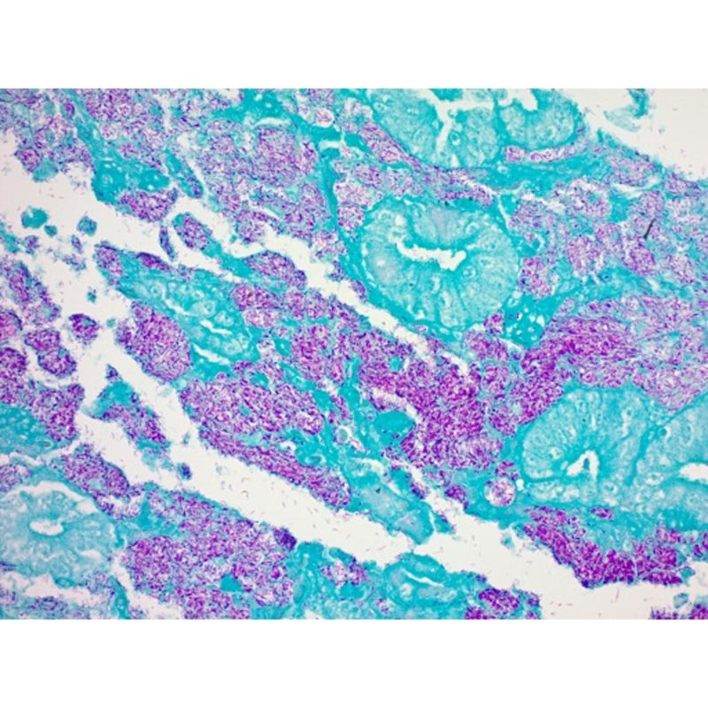 AFB (Ziehl-Neelsen) Stain Kit, Volume Optimized