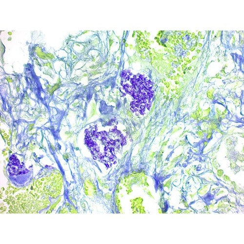 Pneumocystis Stain Kit, Volume Optimized