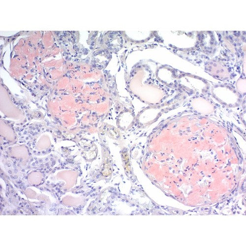 Amyloid Stain Kit (Congo Red), Volume Optimized